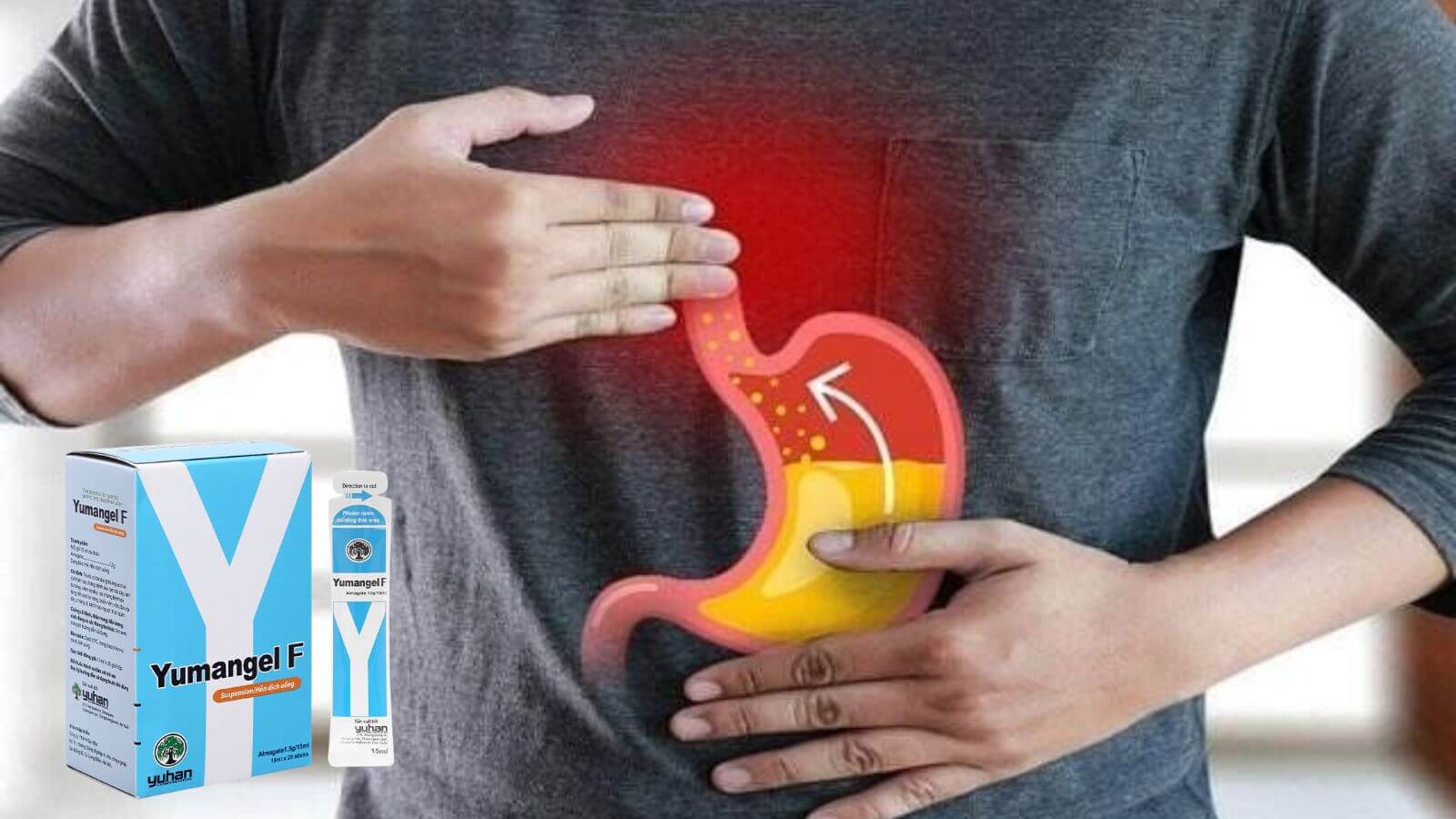 Yumangel F l&agrave; thuốc thuộc nh&oacute;m bảo vệ ni&ecirc;m mạc dạ d&agrave;y