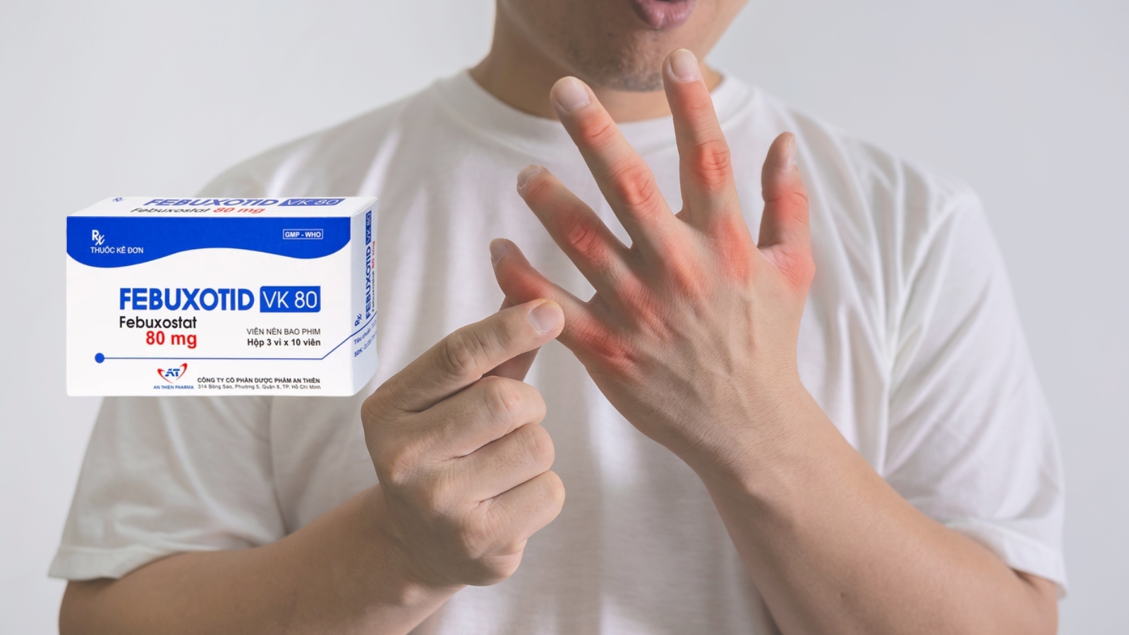 Febuxotid l&agrave; một lựa chọn hiệu quả trong Bắn Cá HZ88 là trò chơi giải trí điện tử tăng acid uric ở bệnh nh&acirc;n gout