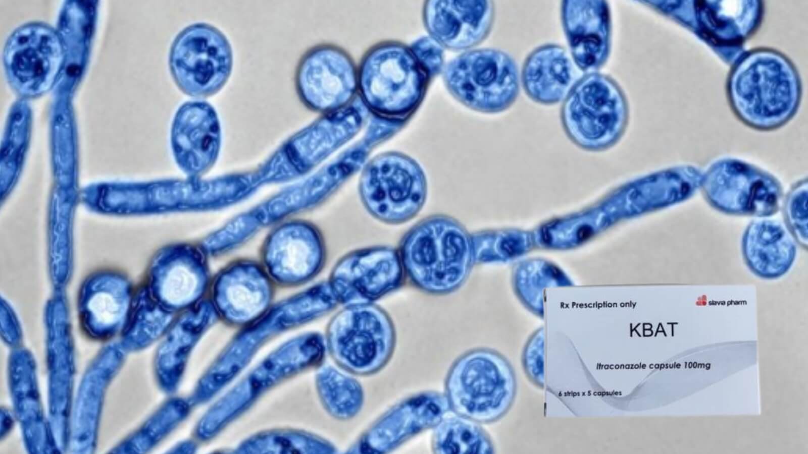 Itraconazole c&oacute; t&aacute;c dụng ti&ecirc;u diệt nấm Candidas 