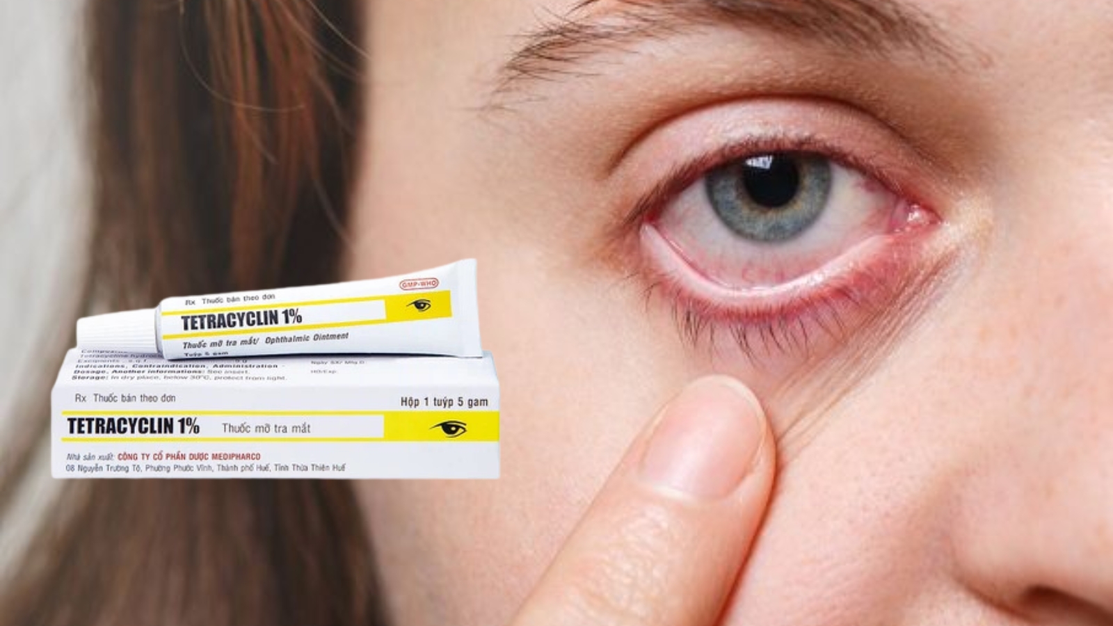 Tetracyclin - Lựa chọn h&agrave;ng đầu của c&aacute;c chuy&ecirc;n gia y tế trong Bắn Cá HZ88 là trò chơi giải trí điện tử bệnh đau mắt hột