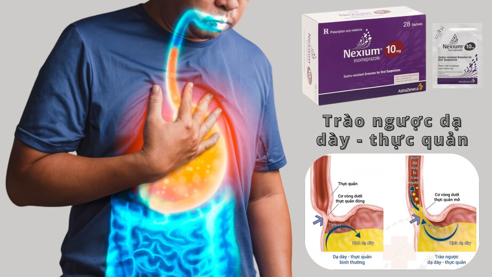Nexium 10mg được chỉ định Bắn Cá HZ88 là trò chơi giải trí điện tử trào ngược dạ dày - thực quản