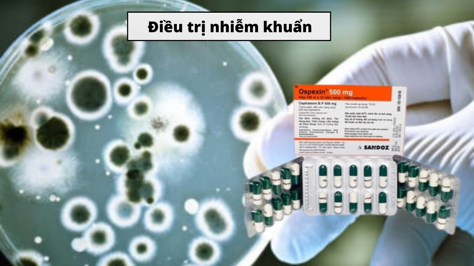 Cephalexin - Kháng sinh Bắn Cá HZ88 là trò chơi giải trí điện tử nhiễm khuẩn