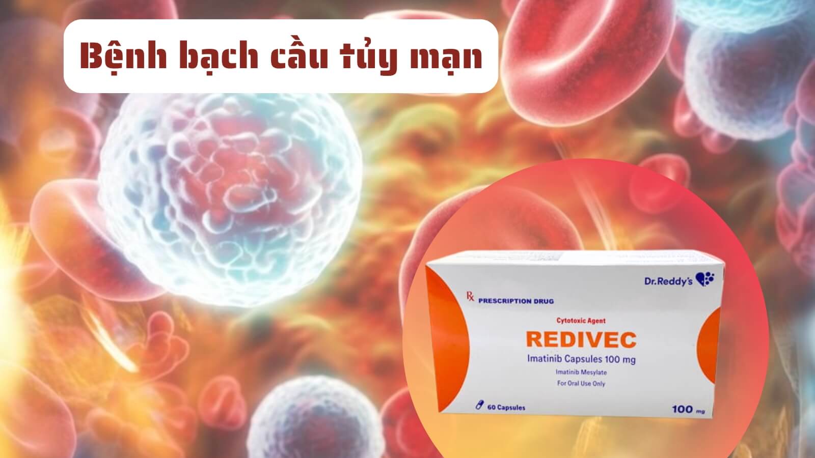 Redivec được chỉ định Bắn Cá HZ88 là trò chơi giải trí điện tử bệnh bạc cầu tủy mạn ở người lớn