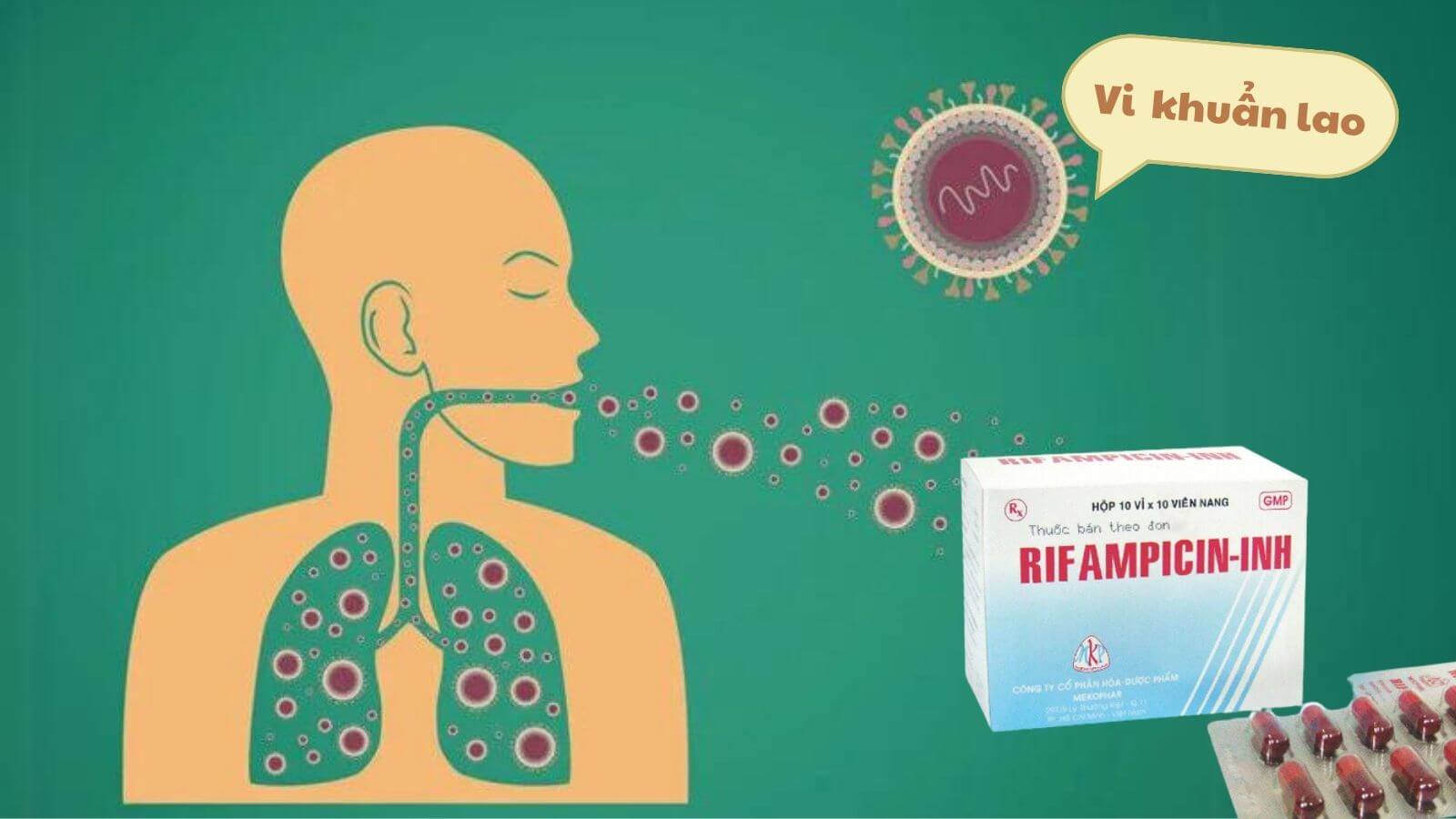 Rifampicin INH giúp Bắn Cá HZ88 là trò chơi giải trí điện tử lao phổi và lao ngoài phổi hiệu quả