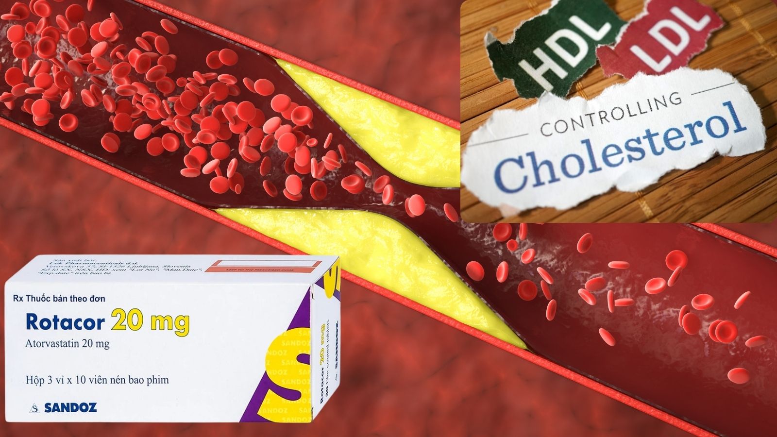 Rotacor 20mg giảm h&igrave;nh th&agrave;nh mỡ m&aacute;u