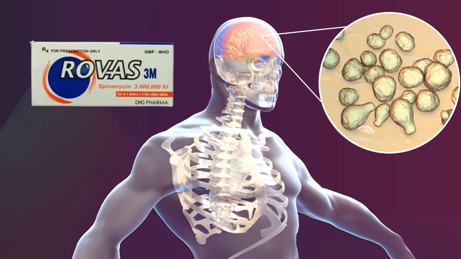Thuốc Rovas 3M được c&aacute;c chuy&ecirc;n gia y tế tin d&ugrave;ng trong dự ph&ograve;ng vi&ecirc;m m&agrave;ng n&atilde;o do Meningococcus