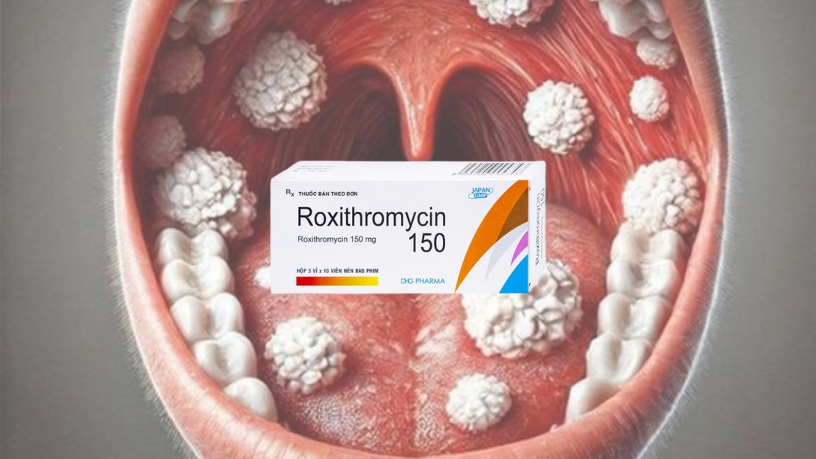 Roxithromycin - Khắc tinh của Trang chủ đăng nhập HZ88 không chặn tặng 88K g&acirc;y ra bệnh bạch hầu