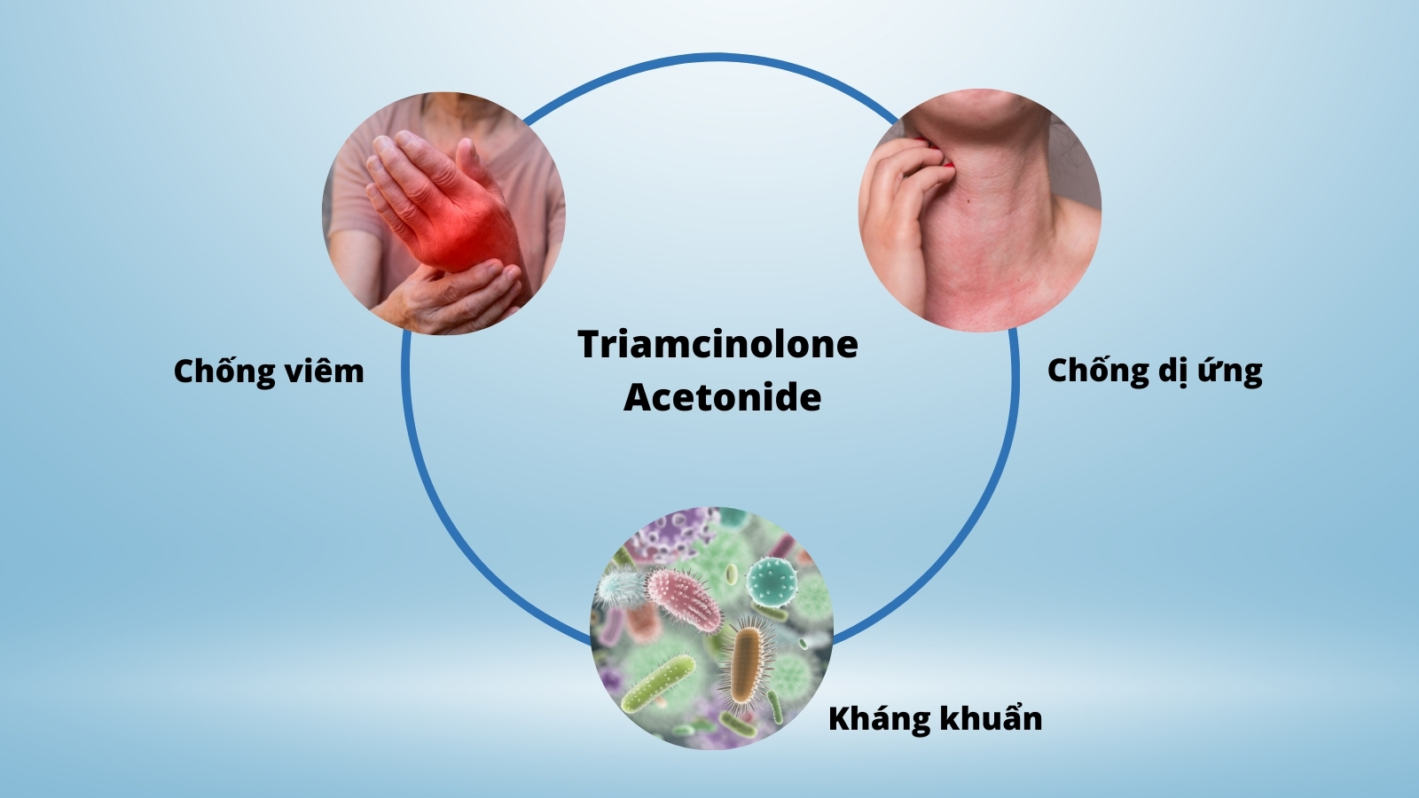 Triamcinolone acetonide l&agrave; một corticosteroid tổng hợp c&oacute; chứa th&agrave;nh phần flo