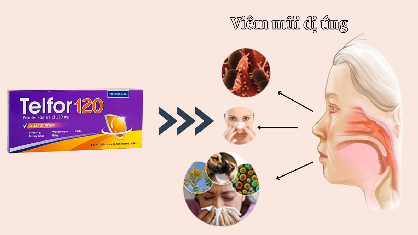 Telfor 120 Bắn Cá HZ88 là trò chơi giải trí điện tử triệu chứng vi&ecirc;m mũi dị ứng