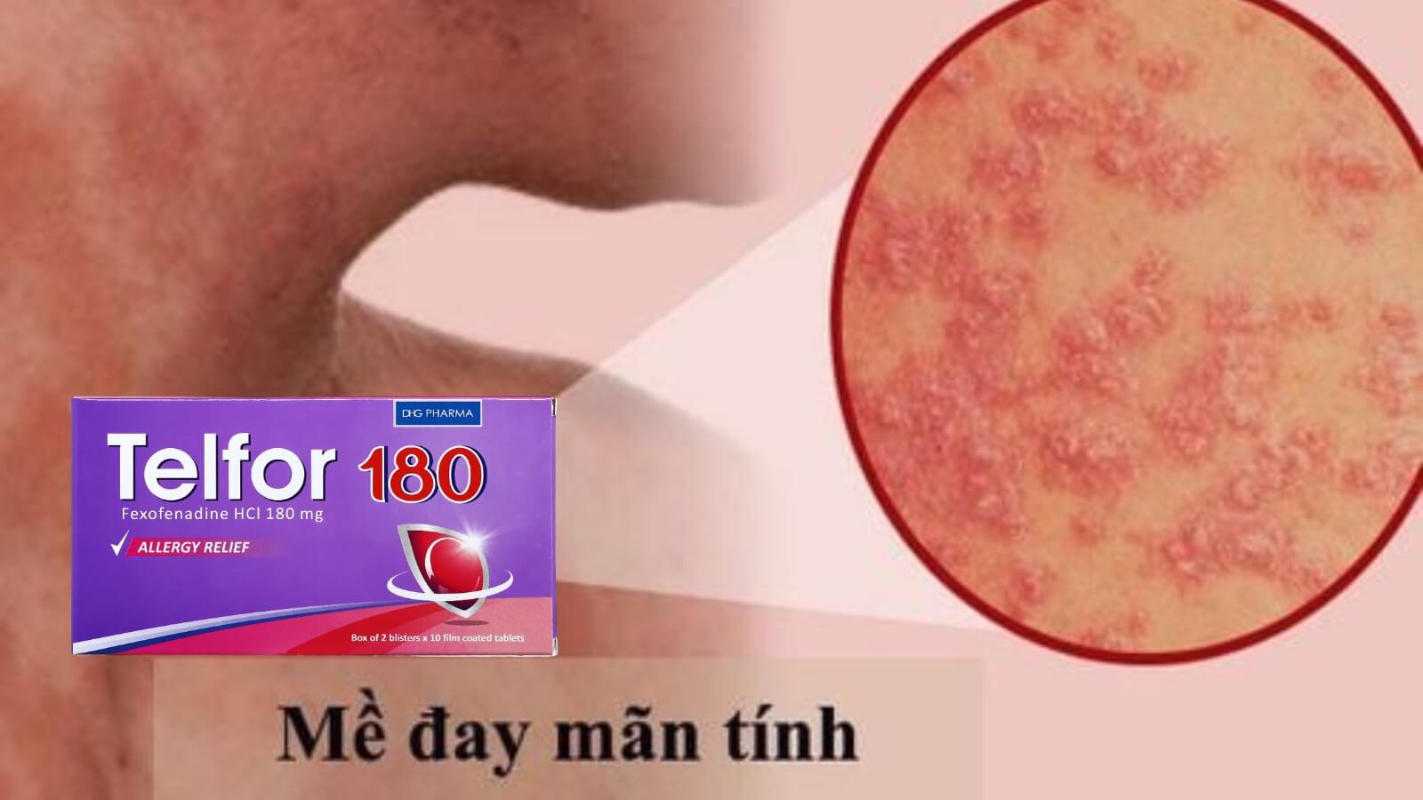 Telfor 180 Bắn Cá HZ88 là trò chơi giải trí điện tử m&agrave;y đay mạn t&iacute;nh