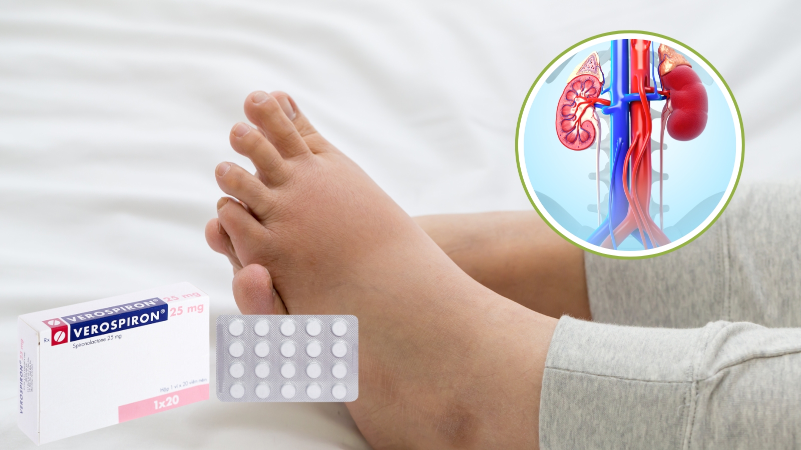 Thuốc Verospiron 25mg Bắn Cá HZ88 là trò chơi giải trí điện tử ph&ugrave; do c&aacute;c nguy&ecirc;n nh&acirc;n kh&aacute;c nhau