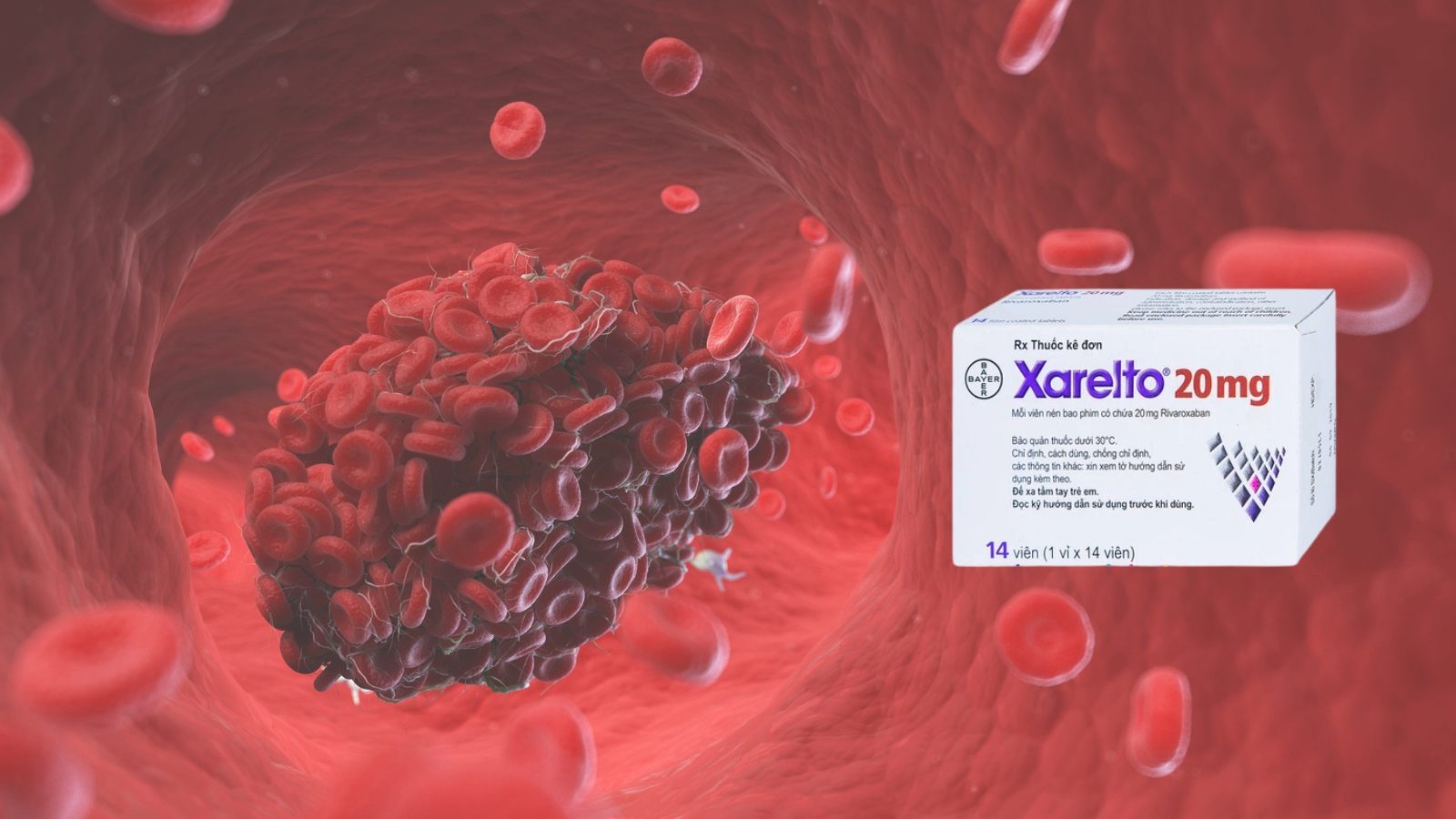 Xarelto 20mg gi&uacute;p giảm qu&aacute; tr&igrave;nh đ&ocirc;ng m&aacute;u, ngăn ngừa h&igrave;nh th&agrave;nh cục m&aacute;u đ&ocirc;ng