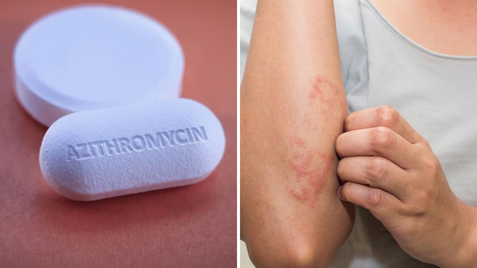 Azithromycin c&oacute; trong thuốc l&agrave; một loại kh&aacute;ng sinh c&oacute; t&aacute;c dụng chống lại Trang chủ đăng nhập HZ88 không chặn tặng 88K
