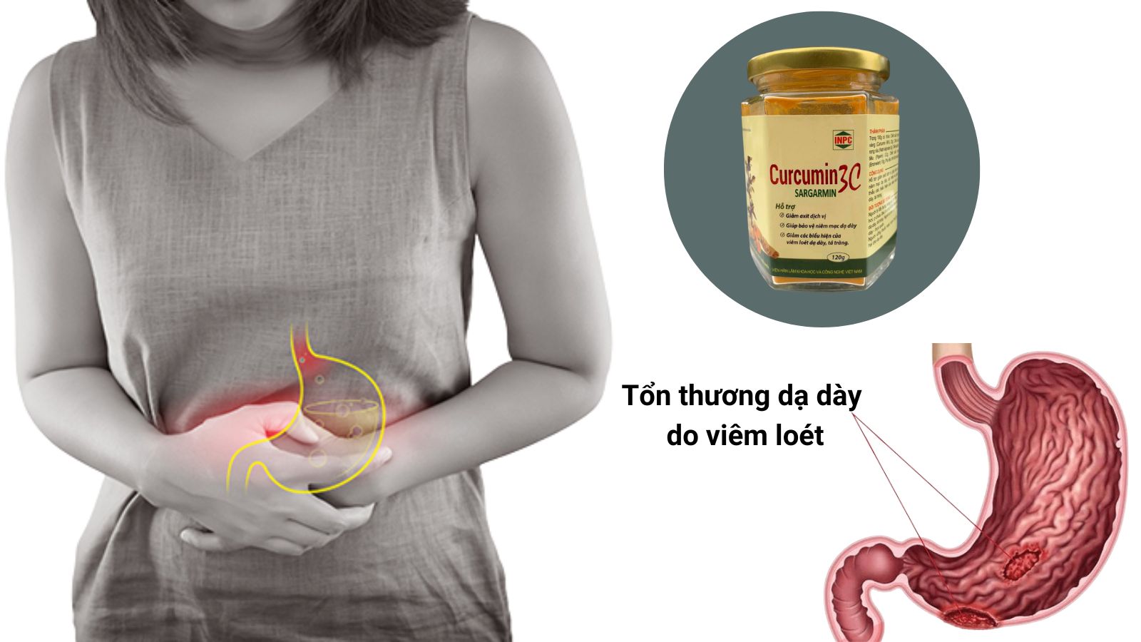 T&aacute;c dụng của tinh chất nghệ Curcumin 3C