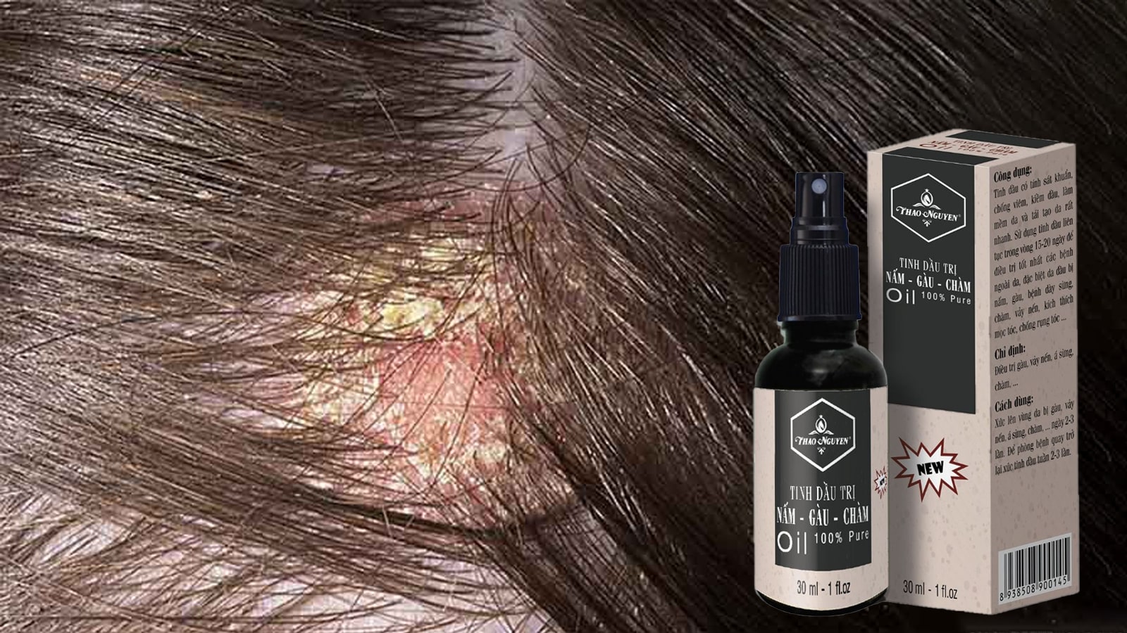 &nbsp;Tinh Dầu Trị Nấm - G&agrave;u - Ch&agrave;m 30ml