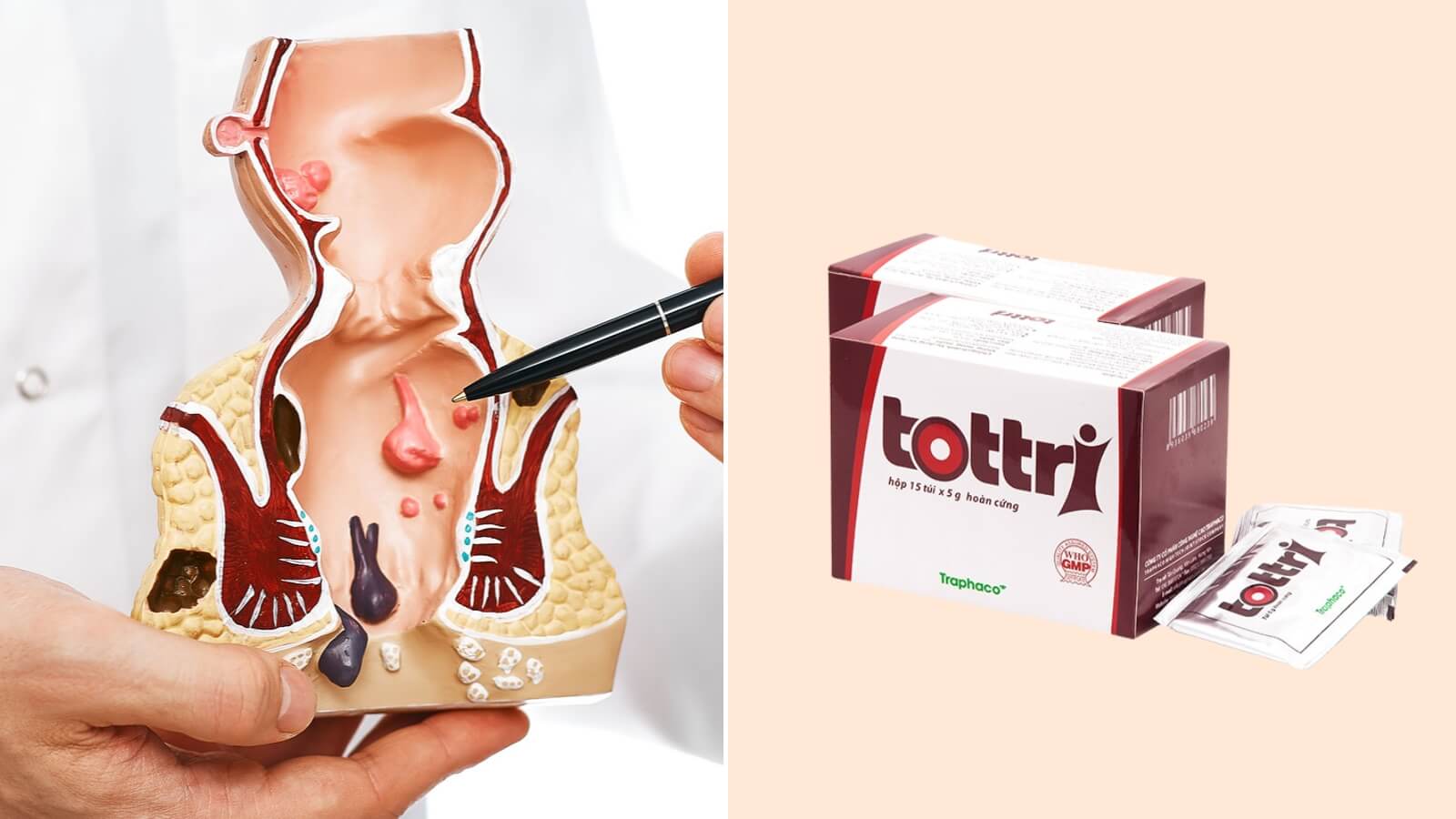 Thuốc Tottri chứa c&aacute;c th&agrave;nh phần từ thi&ecirc;n nhi&ecirc;n, hiệu quả tốt trong Bắn Cá HZ88 là trò chơi giải trí điện tử bệnh trĩ
