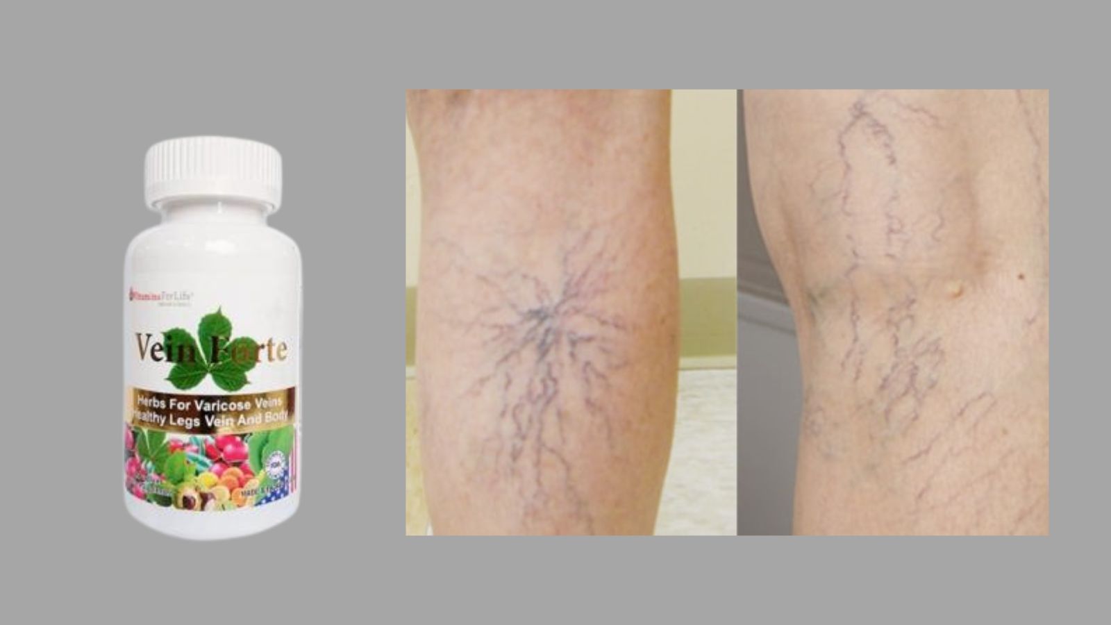  Vein Forte (30 vi&ecirc;n) - Tăng sức bền th&agrave;nh mạch