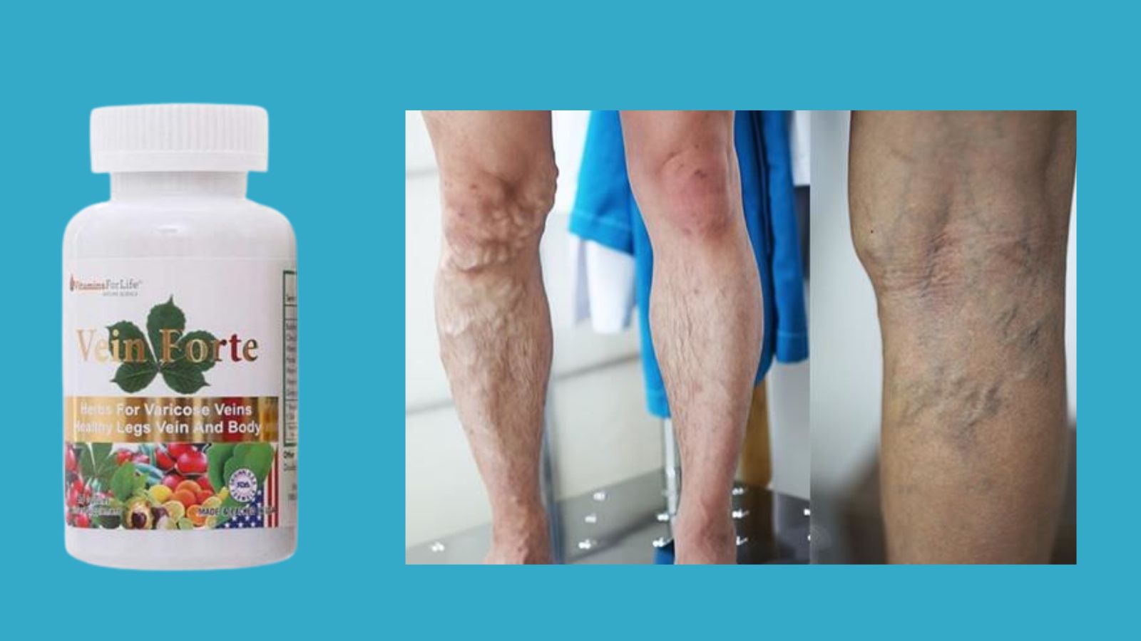 Vein Forte (60 vi&ecirc;n) - Tăng sức bền th&agrave;nh mạch