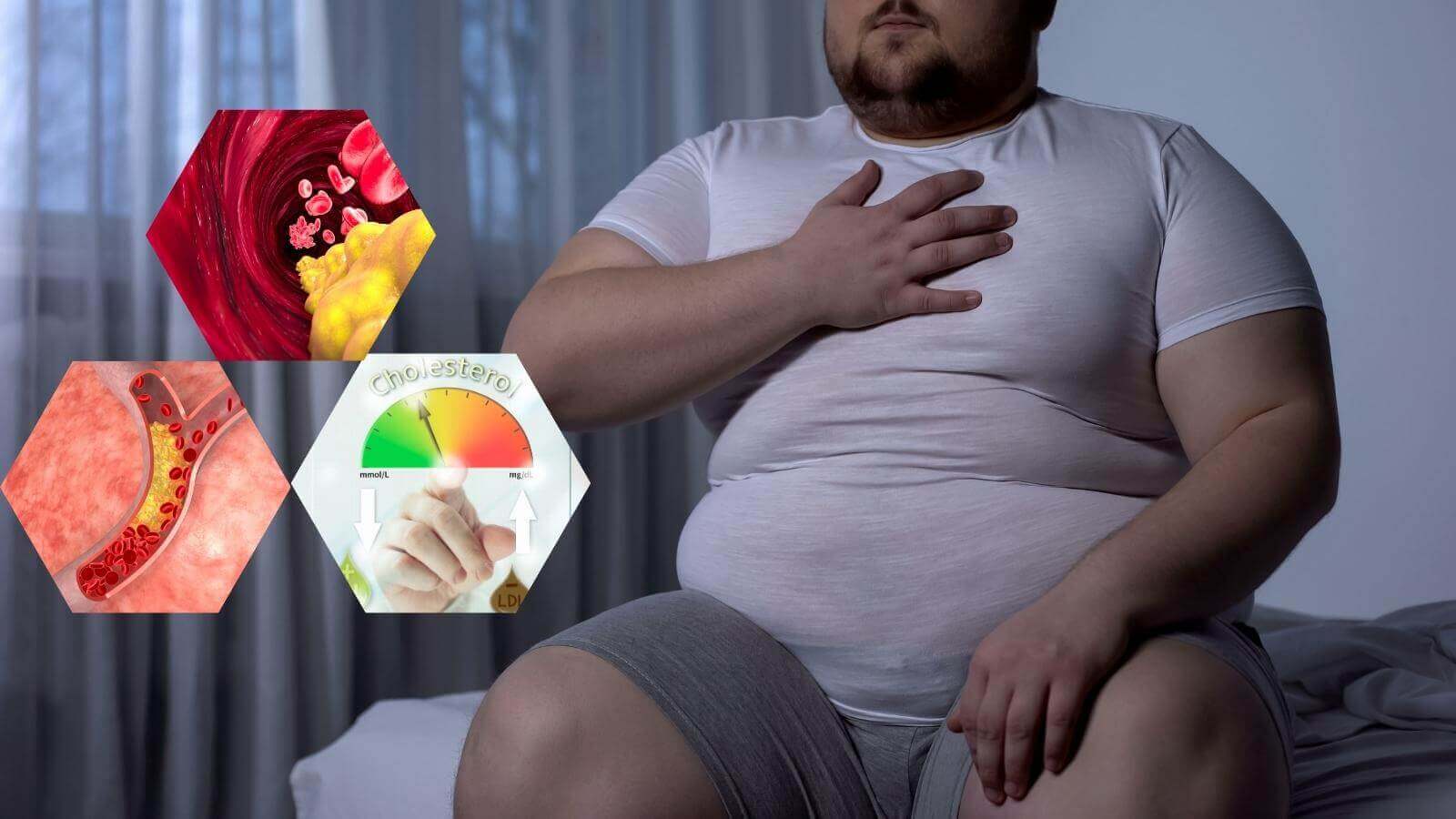 Tỷ lệ mỡ m&aacute;u cao g&acirc;y tắc nghẽn, xơ vữa động mạch nghi&ecirc;m trọng&nbsp;