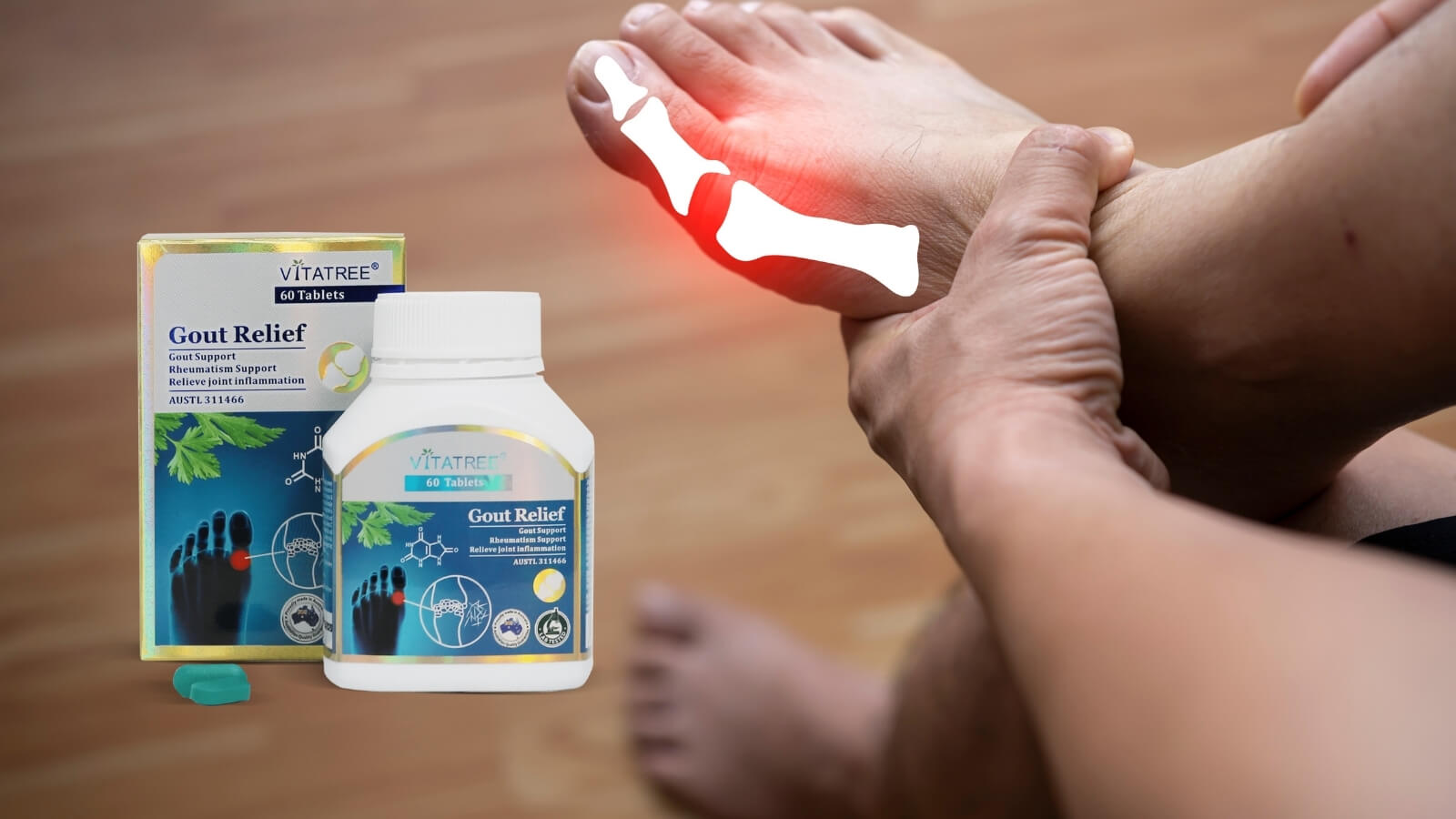 Bệnh Gout g&acirc;y ra nhiều đau đớn